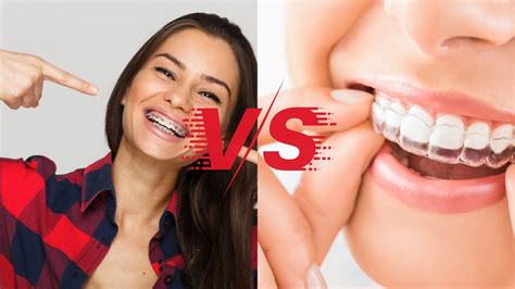 Invisalign Vs Braces Which Is Faster And By How Much