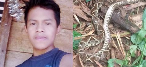 Alta Verapaz Joven Pierde La Vida Tras Ser Mordido Por Una Serpiente