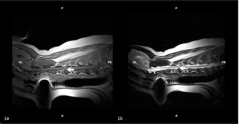 A T1 Weighted Spin Echo Sequence Image In Sagittal Plane B Download Scientific Diagram