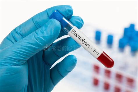 Electrolytes blood test stock image. Image of sample - 90300835