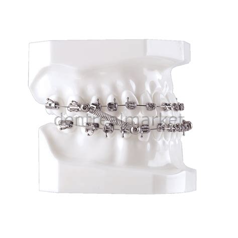 Dynaflex Cs5 Class Ii And Class Iii Corrector With Self Ligating Pivot 5 Patient Kit Dentrealmarket