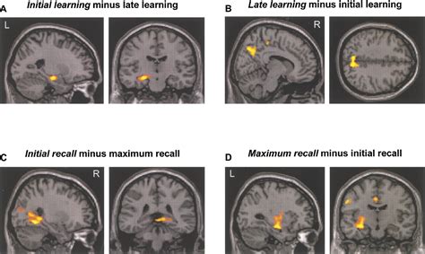 Hippocampal Activations during Repetitive Learning and Recall of ...
