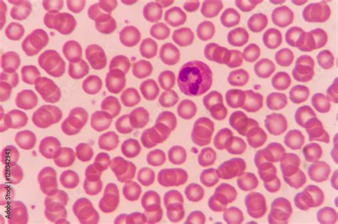 Red Blood Cells Under Microscope 1000x Micropedia 651