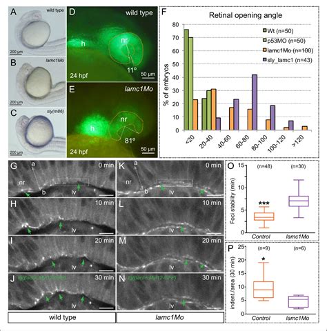 Figure 7 From Analysis Of Cellular Behavior And Cytoskeletal Dynamics