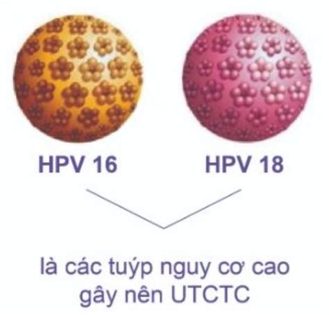 Virus Hpv 16 Hpv 18 Gây Bệnh Ung Thư Cổ Tử Cung Tư Vấn A Z