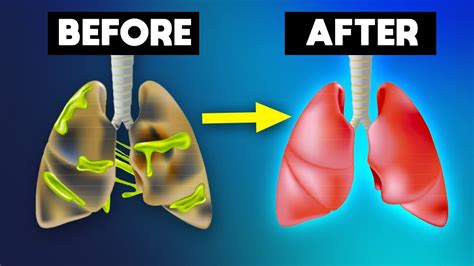 Kick These 8 Deadly Habits Before They Destroy Your Lungs Youtube