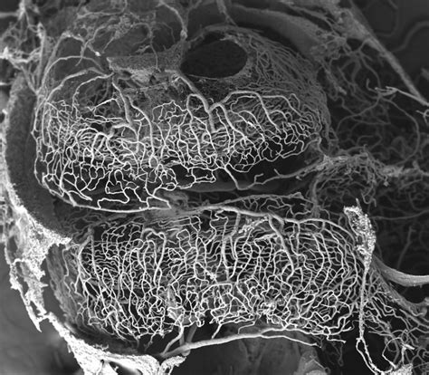 electron microscopy artofit