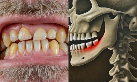 Stages Of A Loose Tooth In Adults