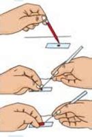 To prepare stained temporary mounts of onion peel - Lab Work « Study Rankers