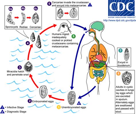 Oriental lung fluke disease - wikidoc