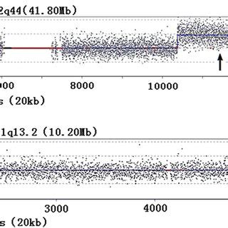 The Cnv Seq Profiles And Partial Karyograms Of The Fetus A B Cnv Seq