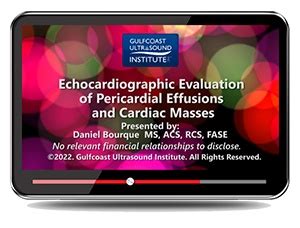 Echocardiographic Evaluation Of Pericardial Effusions And Cardiac Masses