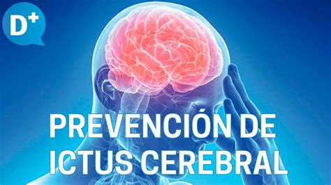 Ictus Tratamiento y prevención del Ictus cerebral YouTube