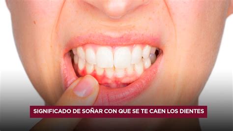 Qué significa soñar con que se te caen los dientes Lo que debes