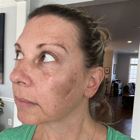 Franz Naked Sunshield Peptide Eye Patches Review TLC