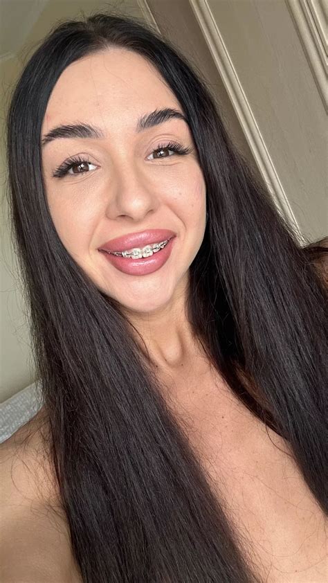 A Smiley Face With Braces Nudes Braceface NUDE PICS ORG