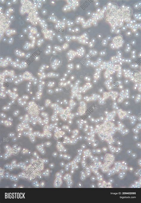 yeast cells  image photo  trial bigstock