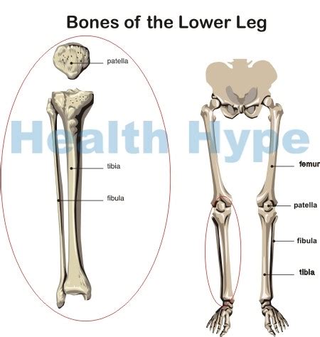 shin pain  shin splints  symptoms  treatment healthhype