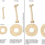 age related   bone geometry