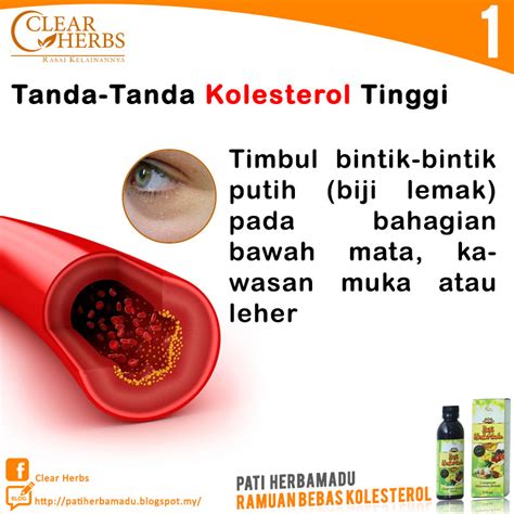 Pati Herbamadu Tanda Tanda Kolesterol Tinggi