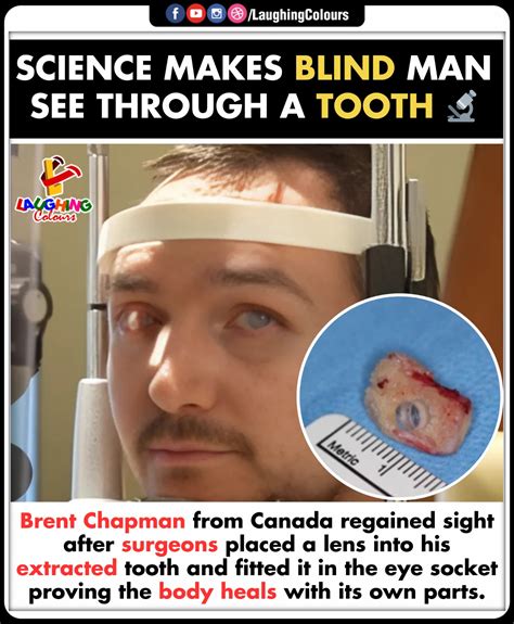Tooth Vision 👁️🦷 #sciencewonders... - Laughing Colours | Facebook