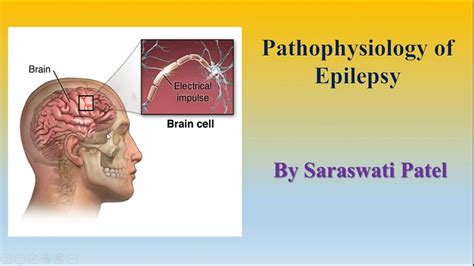 Pathophysiology Of Epilepsy Youtube