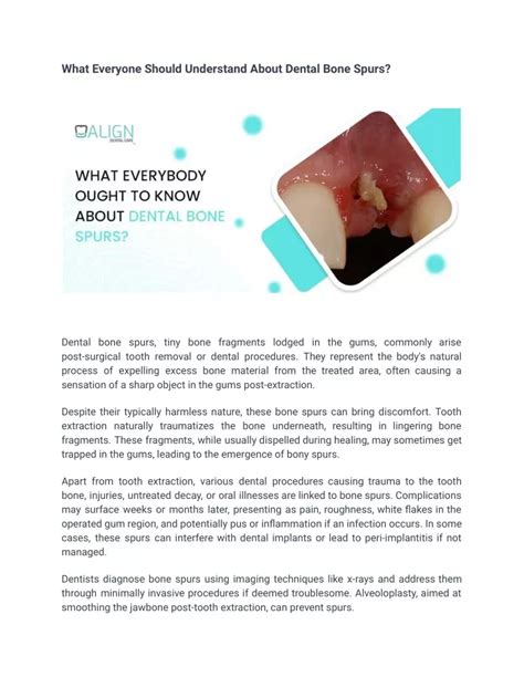 Ppt What Everyone Should Understand About Dental Bone Spurs Powerpoint Presentation Id 12938938