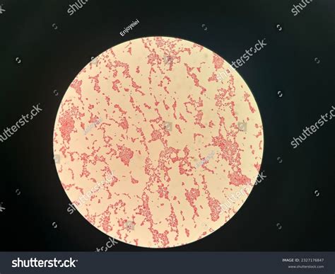 1 Neisseria Sicca Images Stock Photos 3d Objects And Vectors