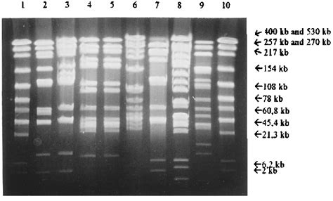 PFGE Separation Of XbaI Restriction Fragments Of Genomic DNAs From P