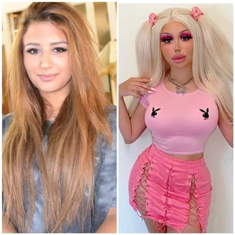 Plastic Surgery Fans Before Ops From Bratz Wannabe To Europes Biggest Boobs Hot Lifestyle News