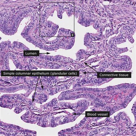 Fallopian Tube Histology Labeled