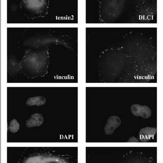 Growth inhibition and induction of apoptosis of HCC cell lines by ...