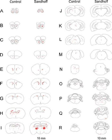 TUNEL staining in the control and Sandhoff brain at 4 months of age ...