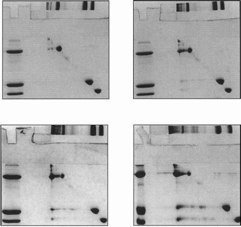 Two Dimensional Electrophoretic Patterns Of 2 1 1 Mixtures Of Of