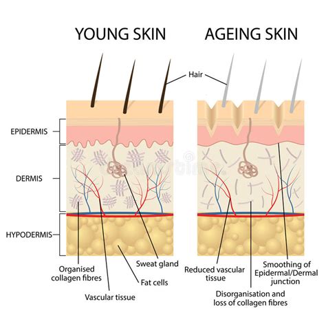 Peau jeune et mature illustration de vecteur Illustration du problème
