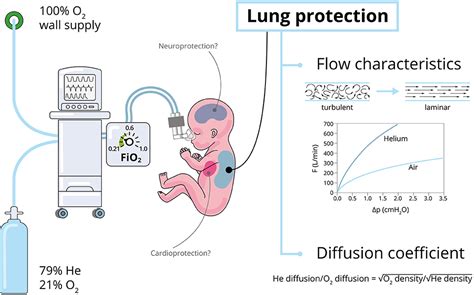 frontiers neonatal applications  heliox  practical review