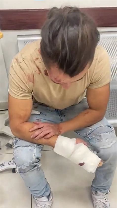 Apuñalaron en la cara a un militar en bar gay en la CDMX Infobae