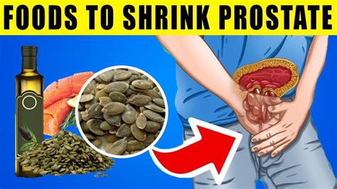 Top 10 Foods To Shrink An Enlarged Prostate Youtube