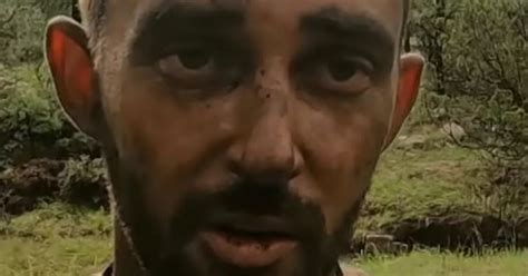 Naked And Afraid Star Gets Medical Help After Burning Penis In Full Frontal Clip Daily Star