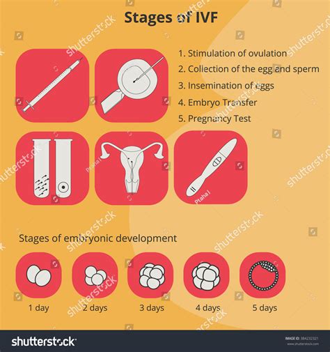 Stages Vitro Fertilization Infographics Process Icons เวกเตอร์สต็อก ปลอดค่าลิขสิทธิ์ 384232321