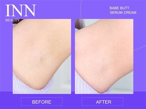 Inn Beauty Babe Butt Serum Cream G