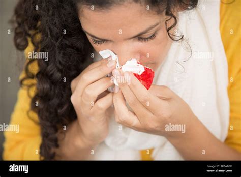 Woman Bleeding From Her Nose Stock Photo Alamy