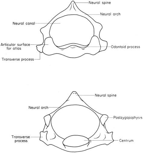 Axis Bone Diagram