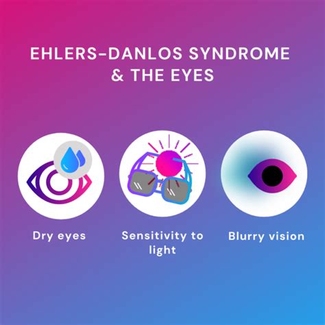 Ehlers Danlos Syndrome The Eyes