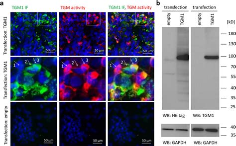 Transglutaminase Activity Persists After Loss Of TGM1 Immunoreactivity