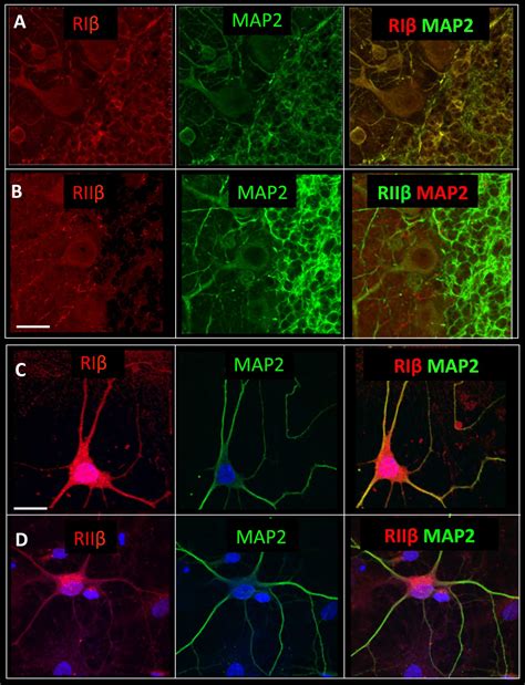 Isoform Specific Subcellular Localization And Function Of Protein