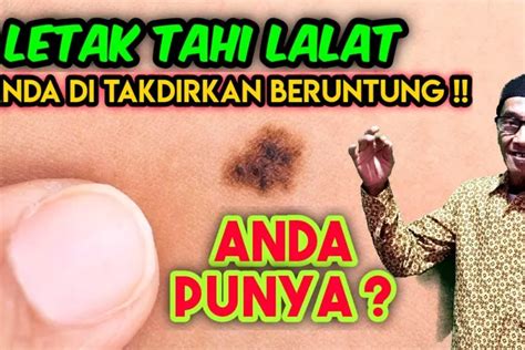 Letak Tahi Lalat Ini Ternyata Merupakan Tanda Pembawa Keberuntungan