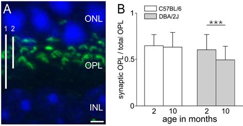 Figure 1 From Rod Photoreceptor Ribbon Synapses In Dba2j Mice Show