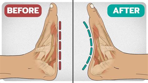 Knee Exercises Foot Arches Balance Exercises Fitness Nutrition