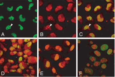 Subcellular Localization Of Calpain 10 In TN4 1 Cells A Green DNA